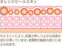 オレンジピールスキン